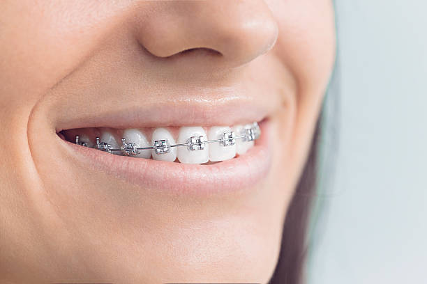 Best Cosmetic Dentistry  in Frankfort, IN